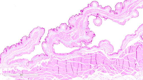 Pincha enlace para ver detalle de capa muscular interna en el pliegue (*)